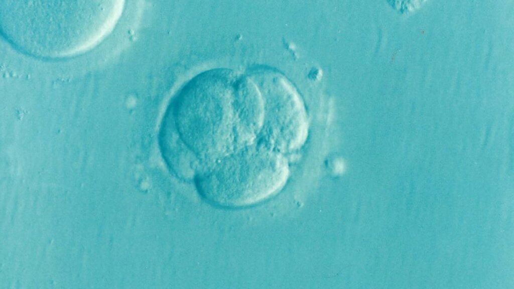 Public opinion is divided on polygenic embryo screening for in vitro fertilization, study finds